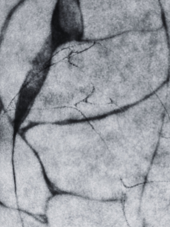 Intestines II