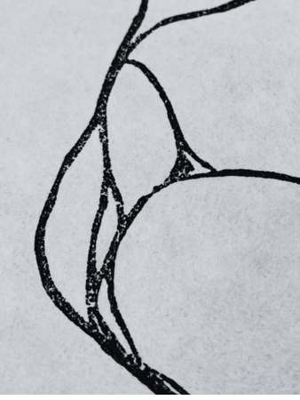 Intestines
